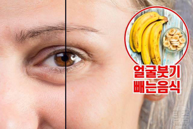 얼굴붓기 빨리 빼는법,얼굴붓기빼는법,얼굴붓기빼는 음식
