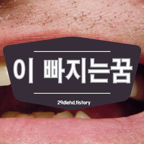 웃으면서-보이는-치아-썸네일
