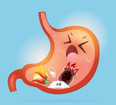 위 내시경 금식시간 위 내시경 전날 음식&amp;#44; 음식 체크&amp;#44; 주의사항