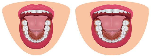 글루타치온 효능과 결핍증상과 제품 고르는 법, 간에 광범위하게 분포하는 천연 항산화제이며 지구상에서 가장 강력한 항산화 효소 중 하나입니다