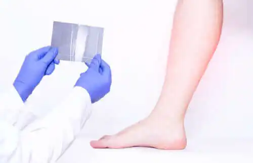 종아리 경련