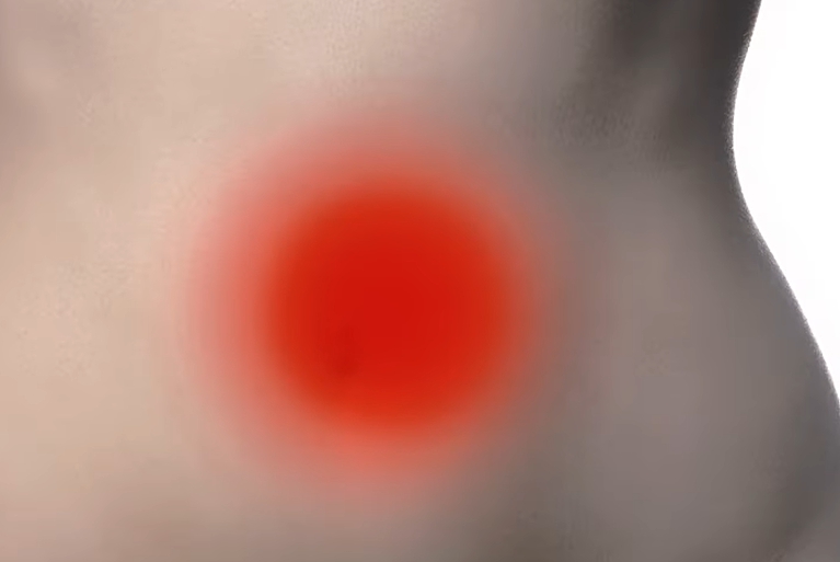 배꼽주위 통증