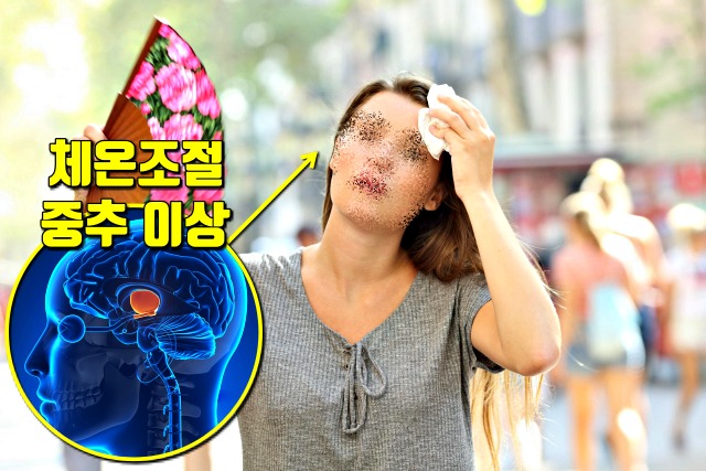 탈수증 원인, 심장 돌연사, 건강 팁줌 매일꿀정보