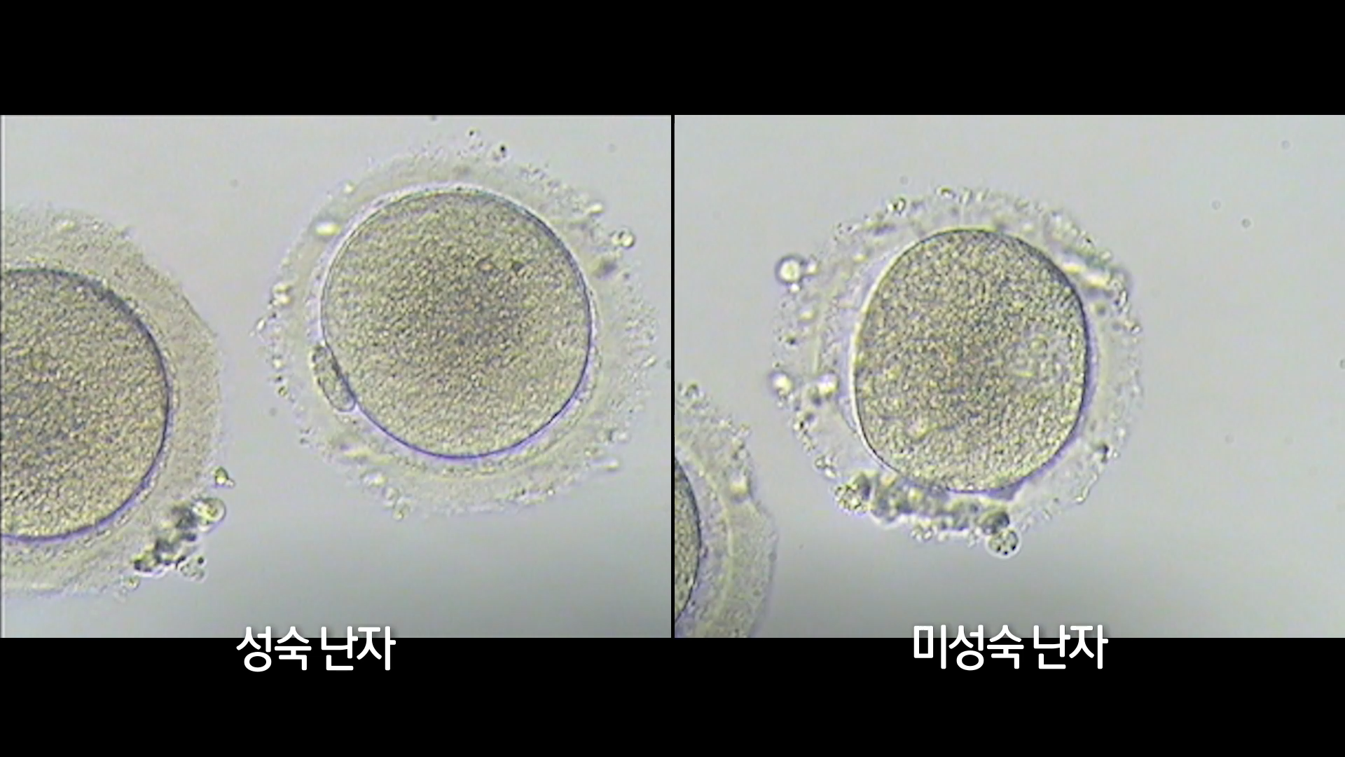 KBS 생로병사의 비밀 836회 난소 노화에 맞서다, 난자 냉동 방법 오늘방송 다시보기 정보