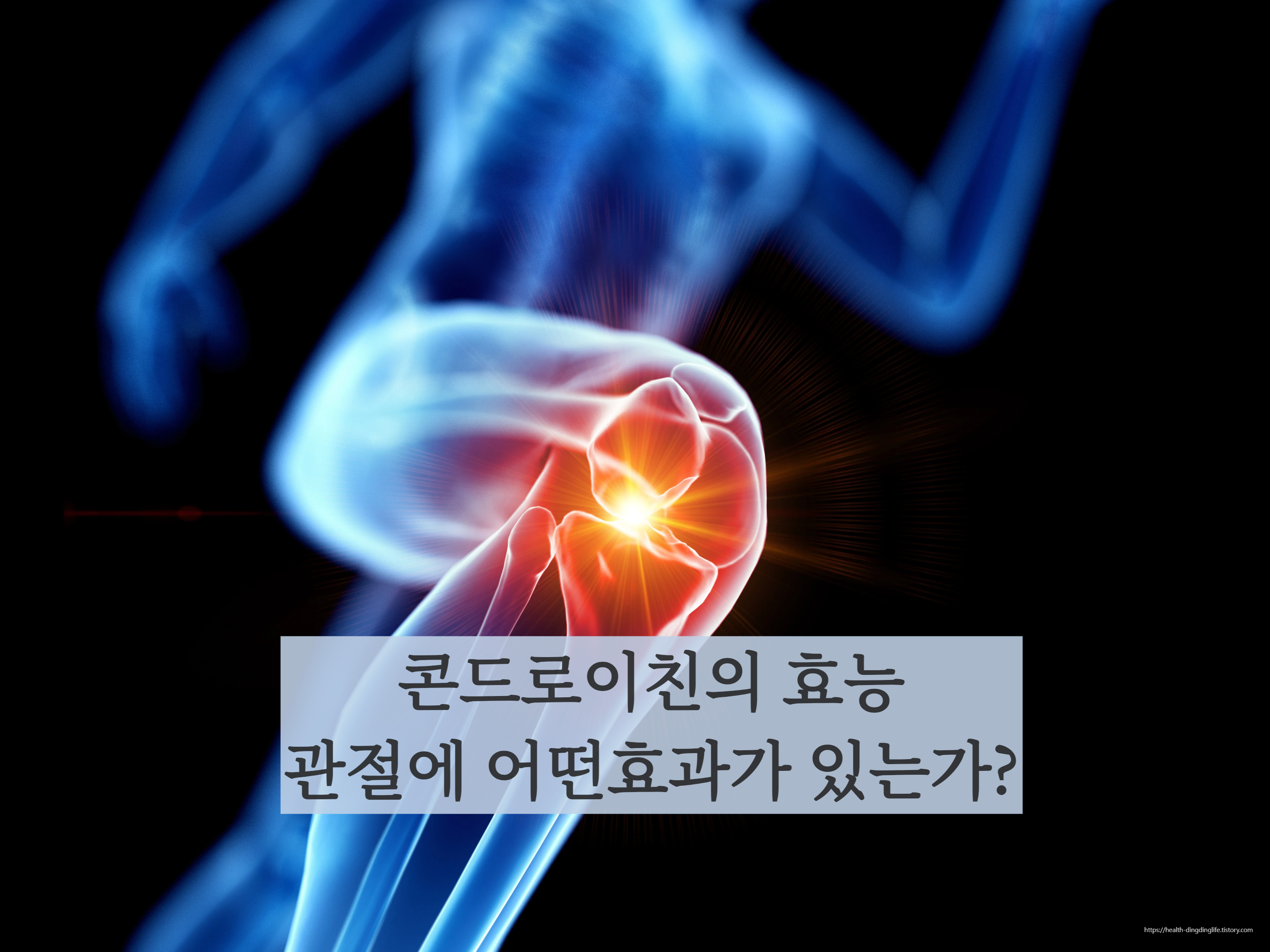 관절 이미지/ 출처- 성모튼튼정형외과