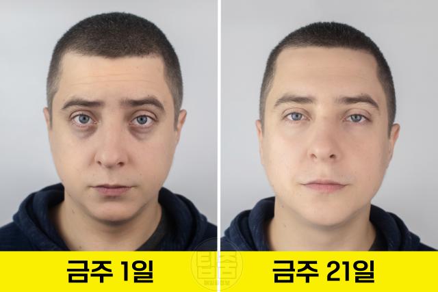 술 끊기 한달 술 끊으면 변화 피부 다크서클