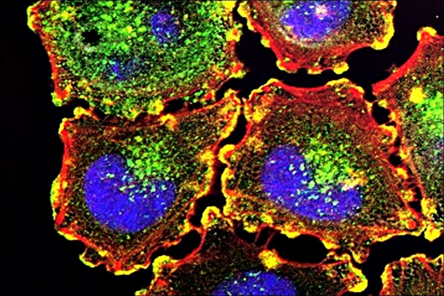 블루베리 효능 10가지