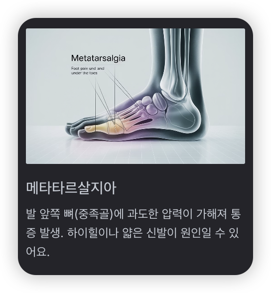 발가락-아래-통증-메타타르살지아