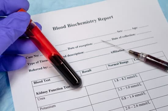 신장 기능 검사: 건강한 신장을 위한 필수 평가