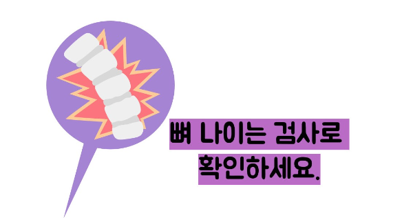 골다공증 수치