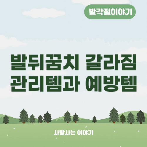 발뒤꿈치 갈라짐 관리템과 예방템