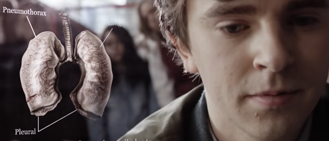 미드 굿닥터 공항 응급처치 기흉 원리