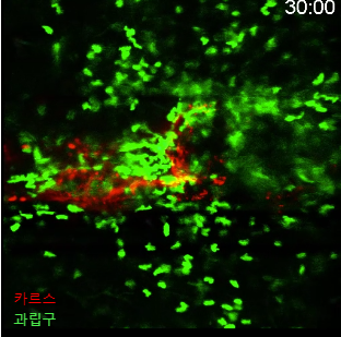 올인워현미경으로 본 피부 염증반응