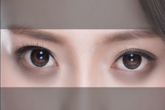 다크서클-다크써클-다크써클원인-다크써클제거-다크써클제거크림