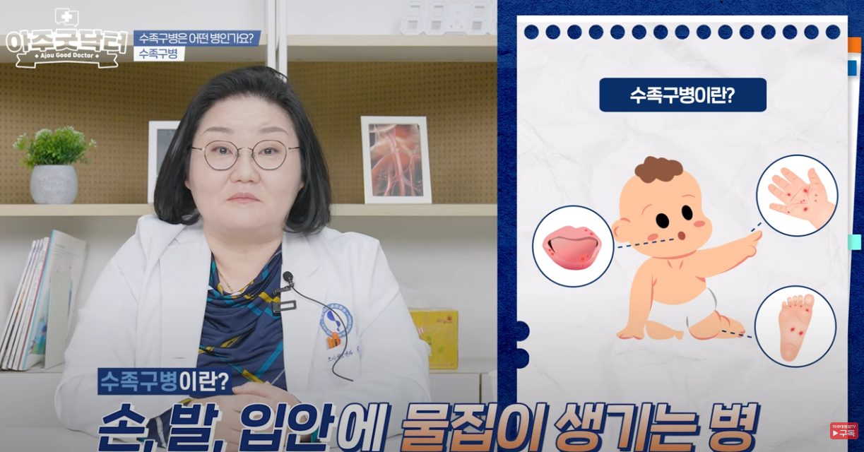 수족구는 손,발,입에 수포가 발생하는 병입니다.