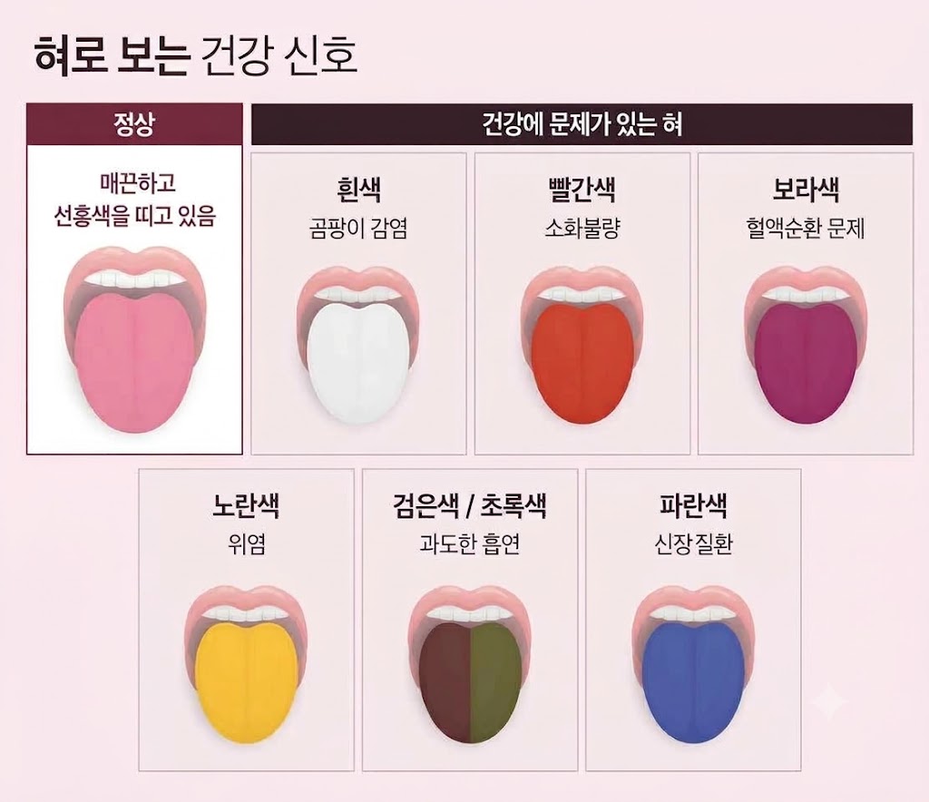 혀 건강