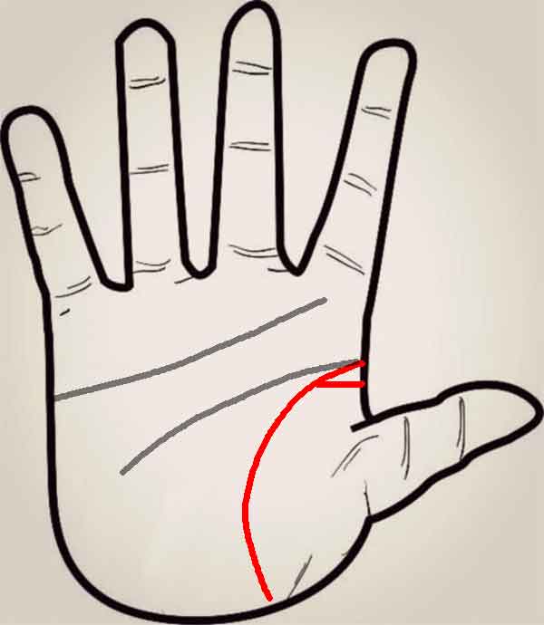 신경 과민한 손금