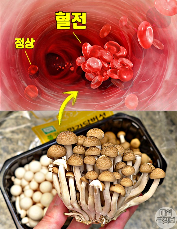 탁해진 피 고지혈증에 좋은 음식 만가닥버섯 효능,팁줌