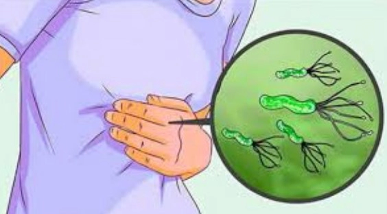 헬리코박터균 검사 방법