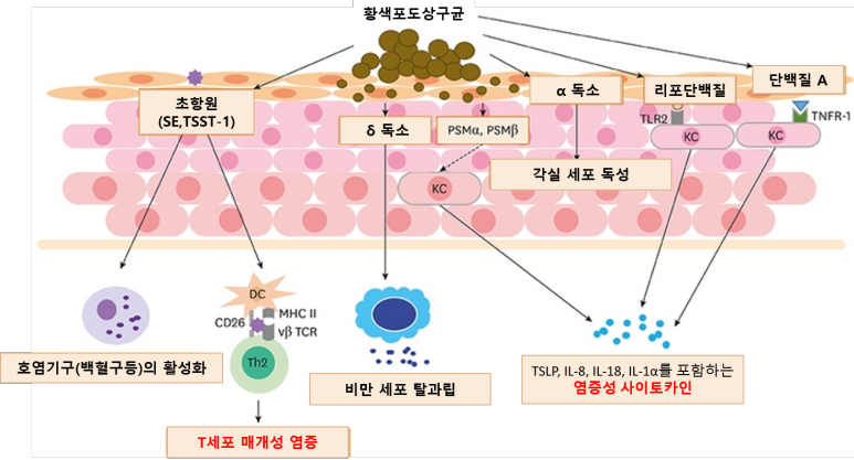 아토피 발생 원인