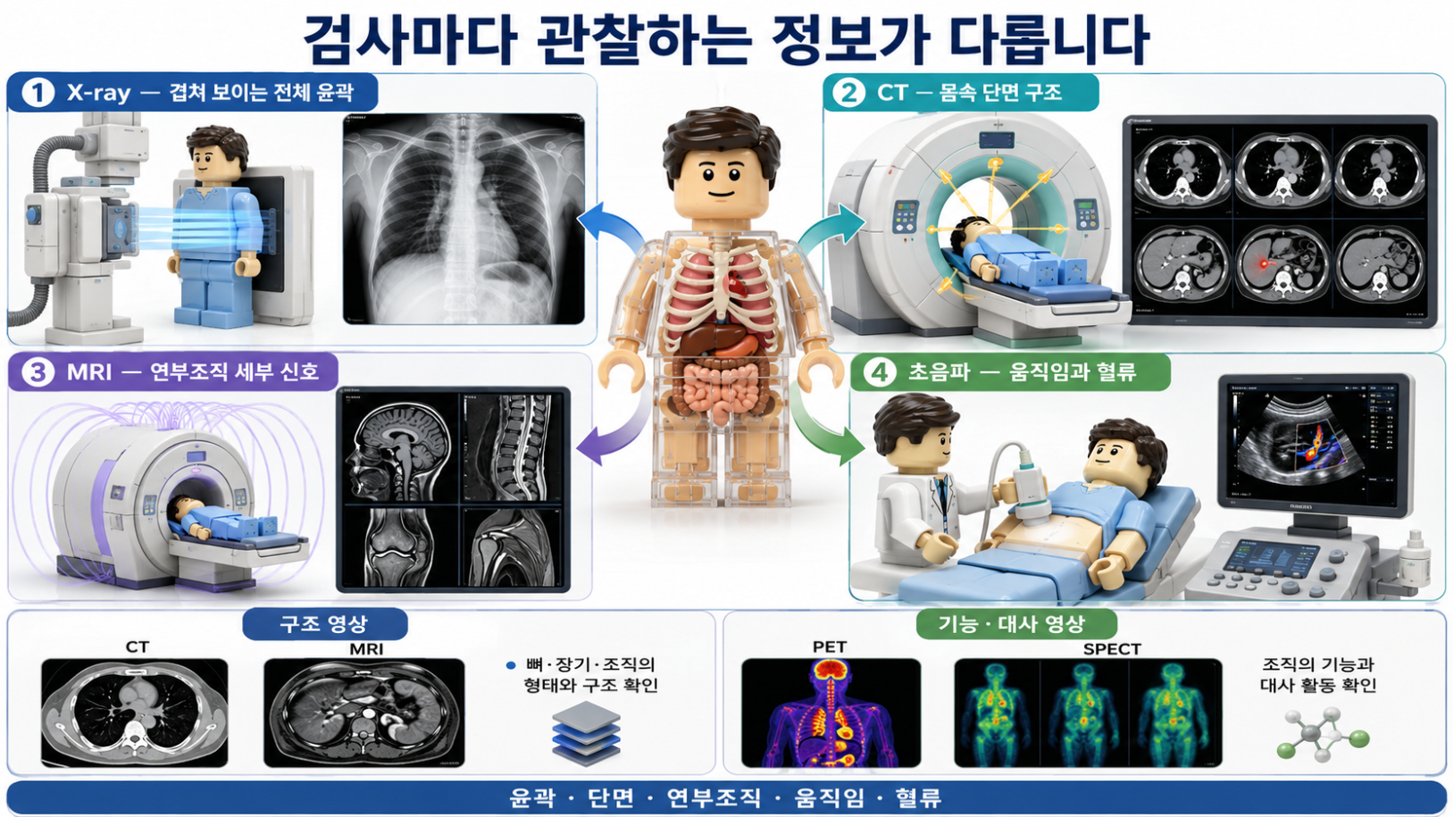 X-ray&middot;CT&middot;MRI&middot;초음파가 영상을 만드는 방식과 관찰 정보 차이를 설명하는 의료 인포그래픽