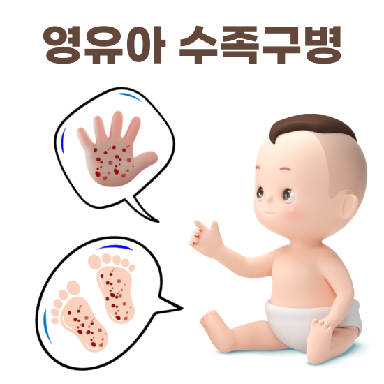 영유아 수족구병