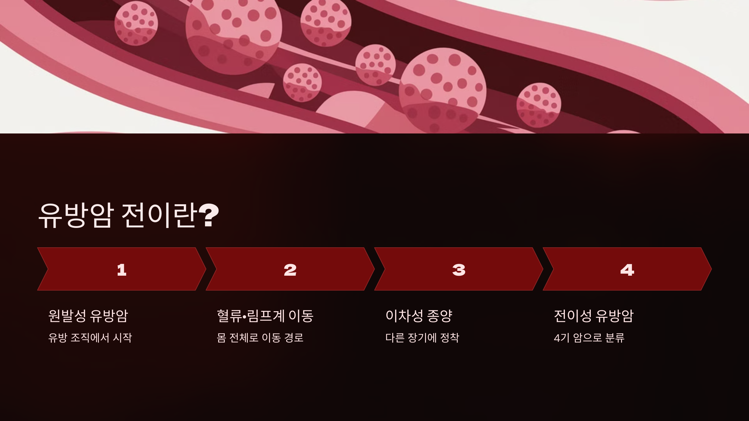 유방암 전이란?