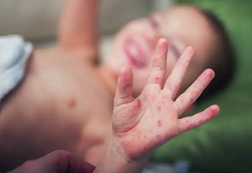 토마토-바이러스