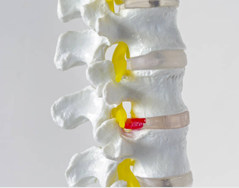 디스크와 관련된 사진