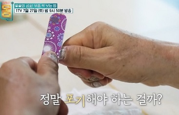무좀싹낫는법