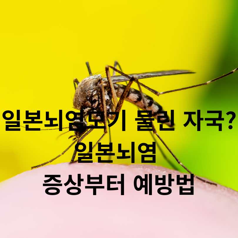 일본뇌염 증상부터 예방법