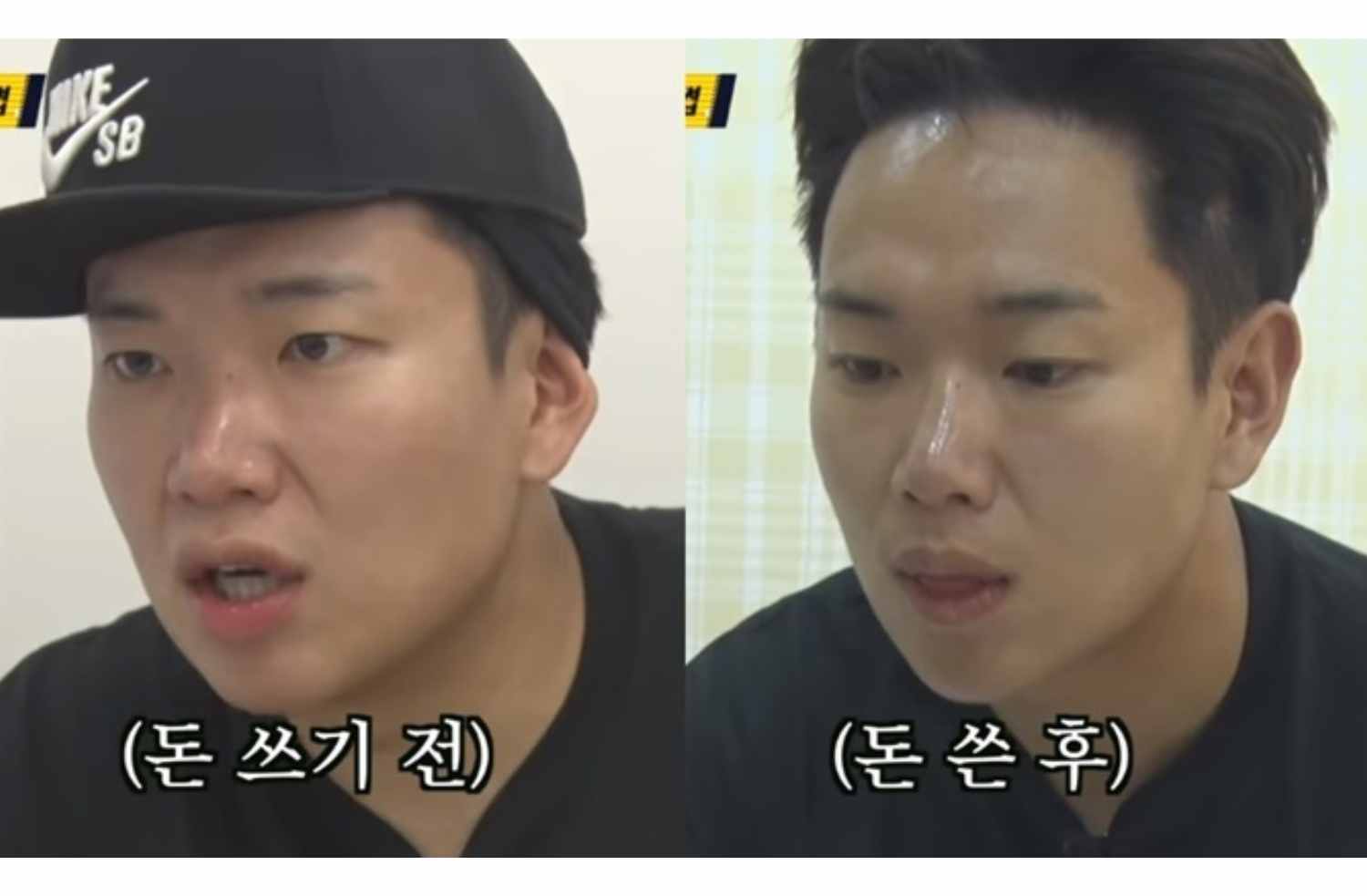 시술 효과