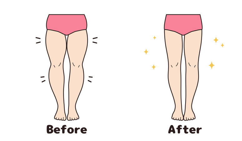 바른 자세가 만들어낸 놀라운 변화