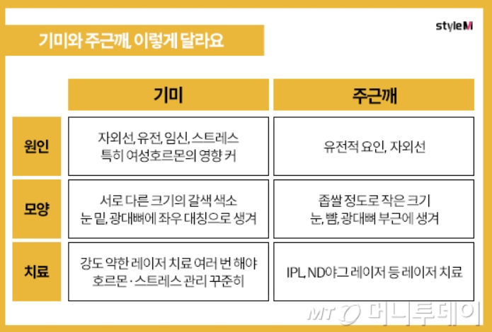 기미와 주근깨의 차이점 설명 표