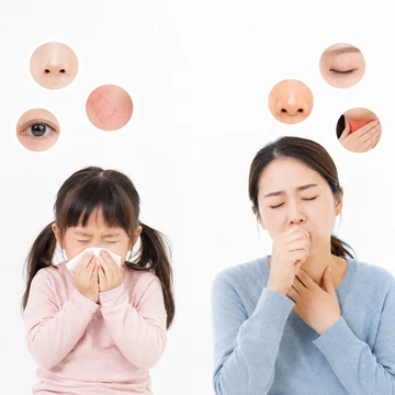 연령별 알레르기 증상 변화 비교5