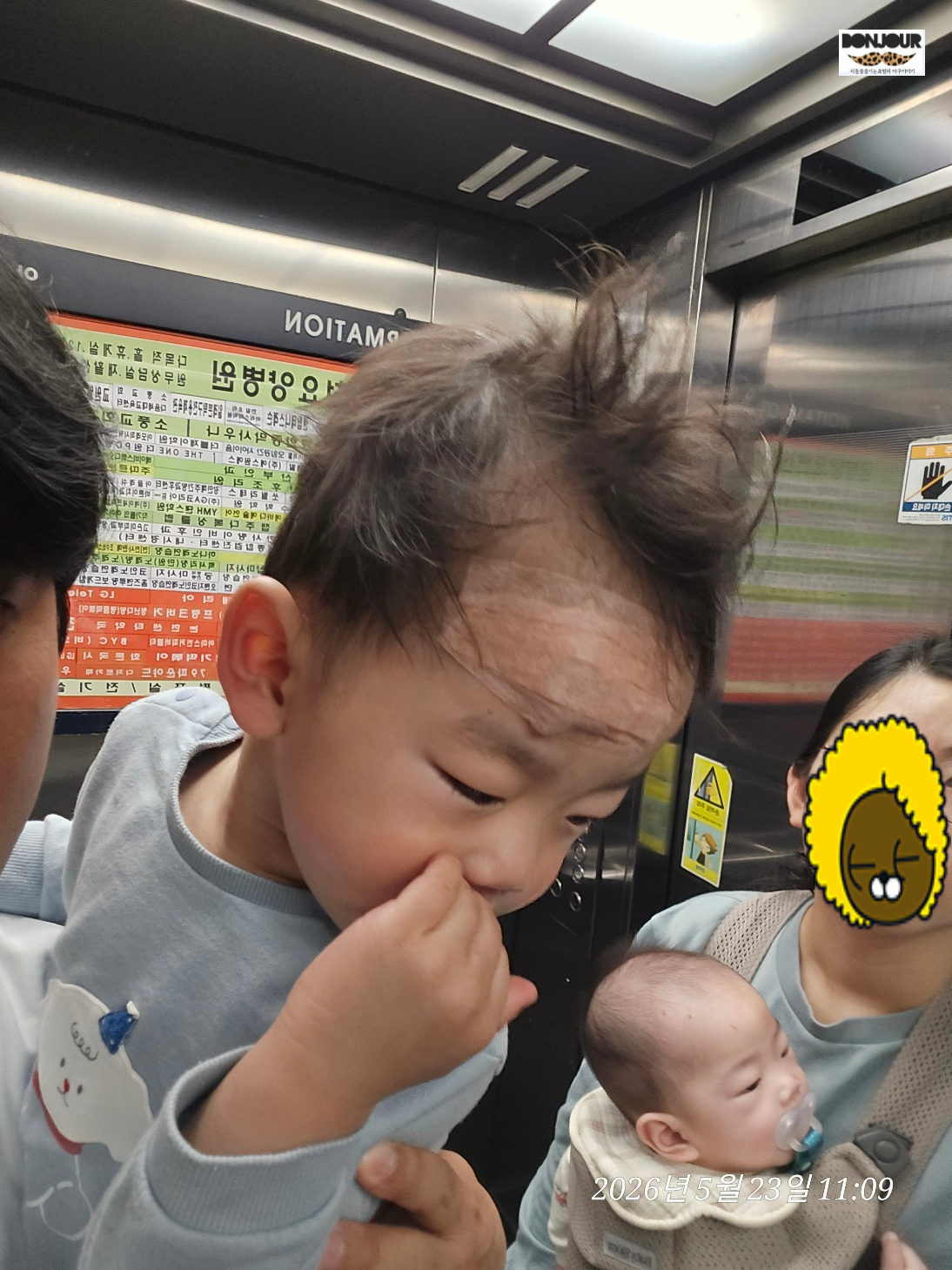 성형외과 이마 봉합 직후 반창고 붙인 모습