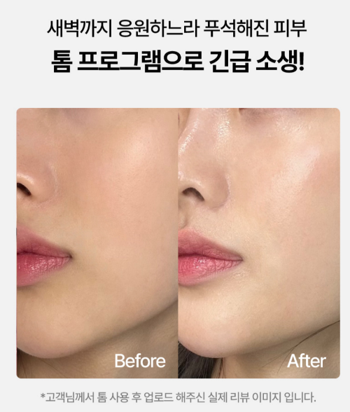 톰 프로그램(THOME) 후기