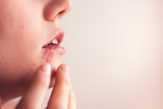 HSV-1 (단순포진 바이러스 1형) – 특징과 증상, 치료
