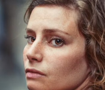 눈밑 처짐 없애는 방법 수술 마사지 예방