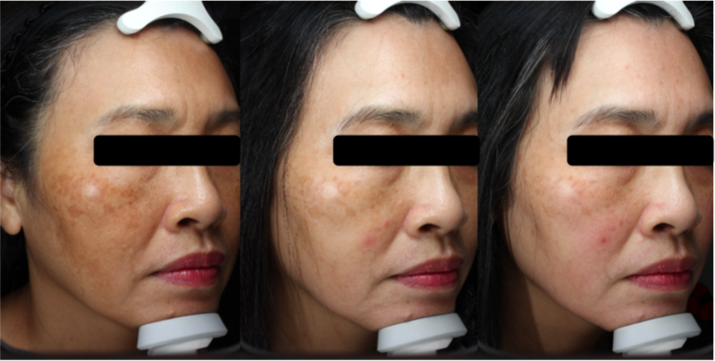 ๊ธฐ๋ฏธ ์์ ๋ ๋ฐฉ๋ฒ