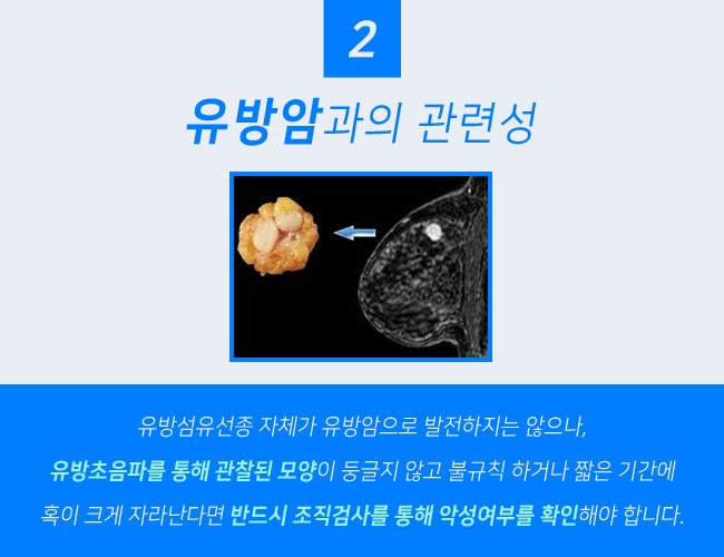 유방 섬유선종 수술, 절제과정, 관리법및 필요성, 중요성