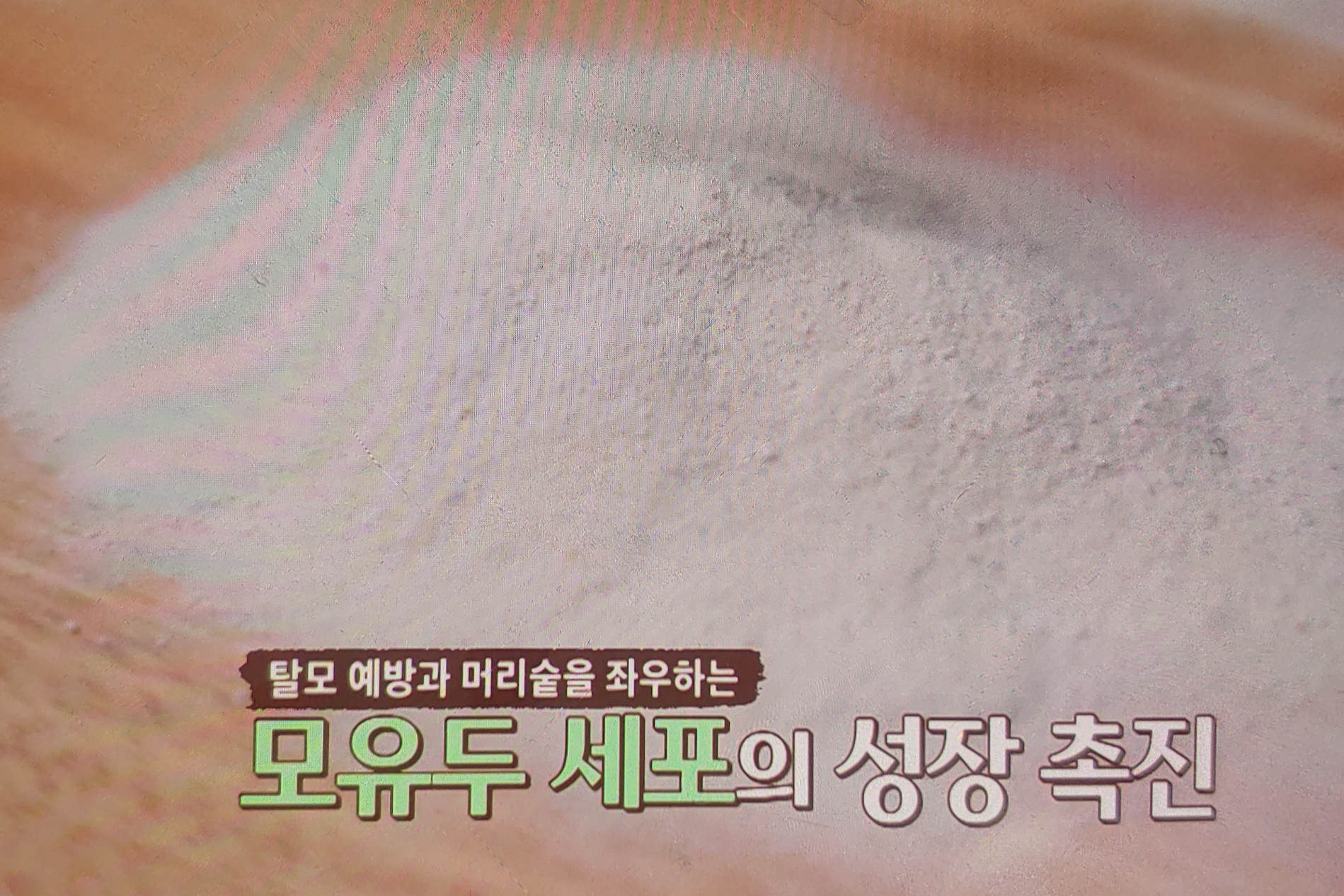 아누카사과 분말 효능