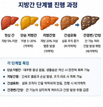 지방간에좋은음식-차-영양제-운동