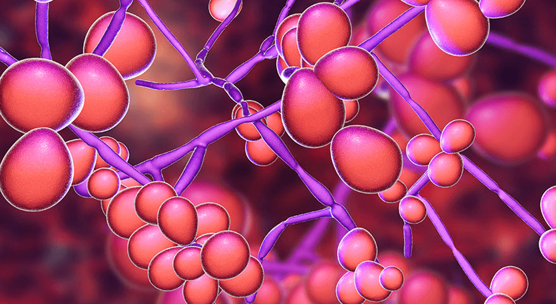 질염-사진-모습1