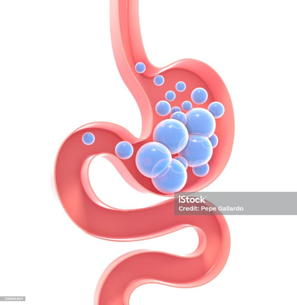 냄새 심한 방귀의 원인과 예방법