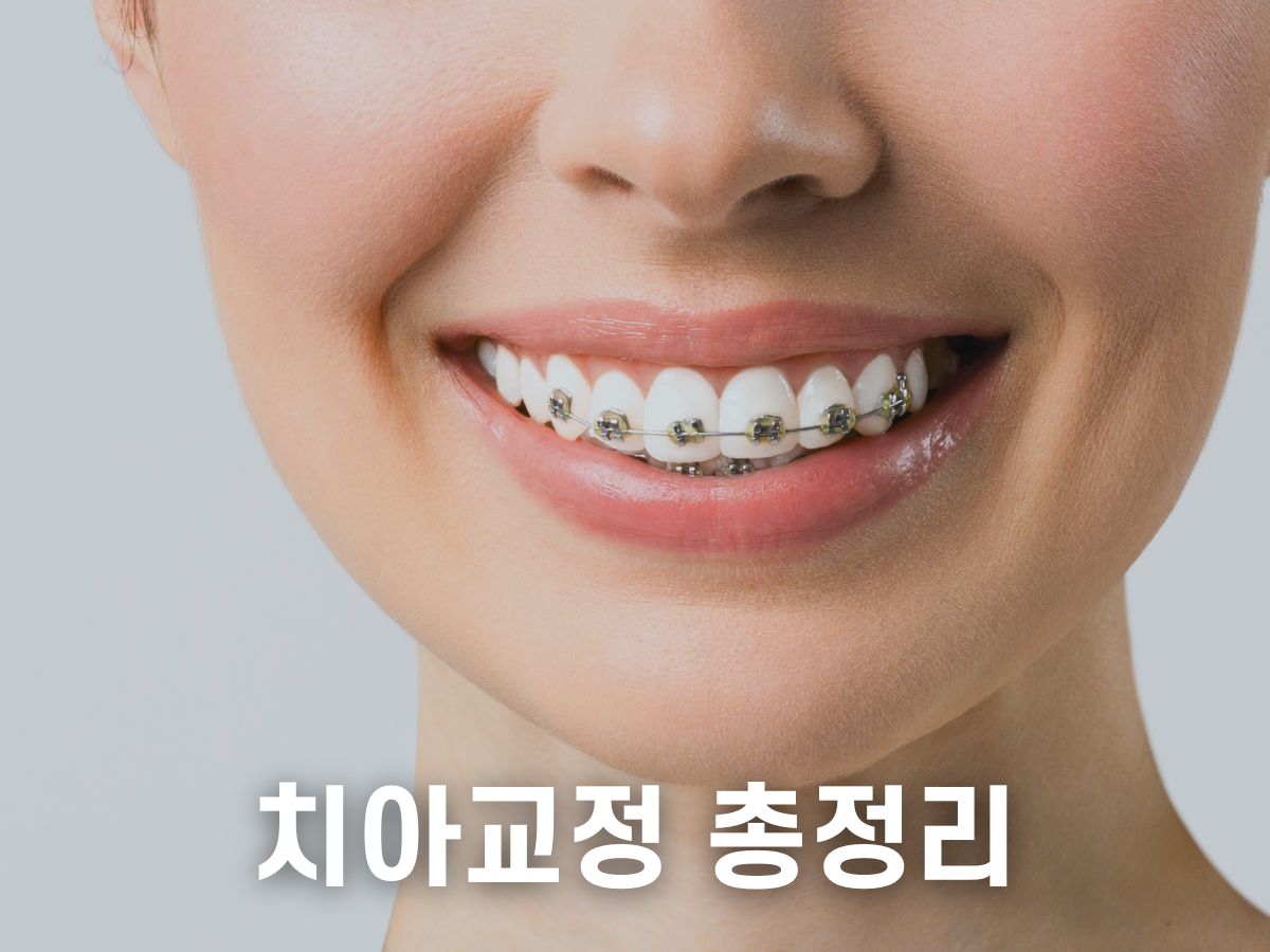치아교정 비용