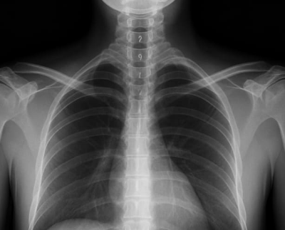 어깨 통증 8초만에 잡는법