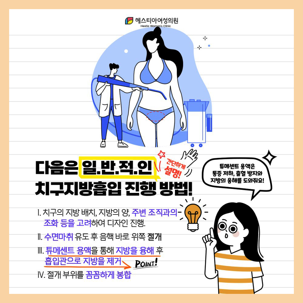 치구지방흡입 진행 방법