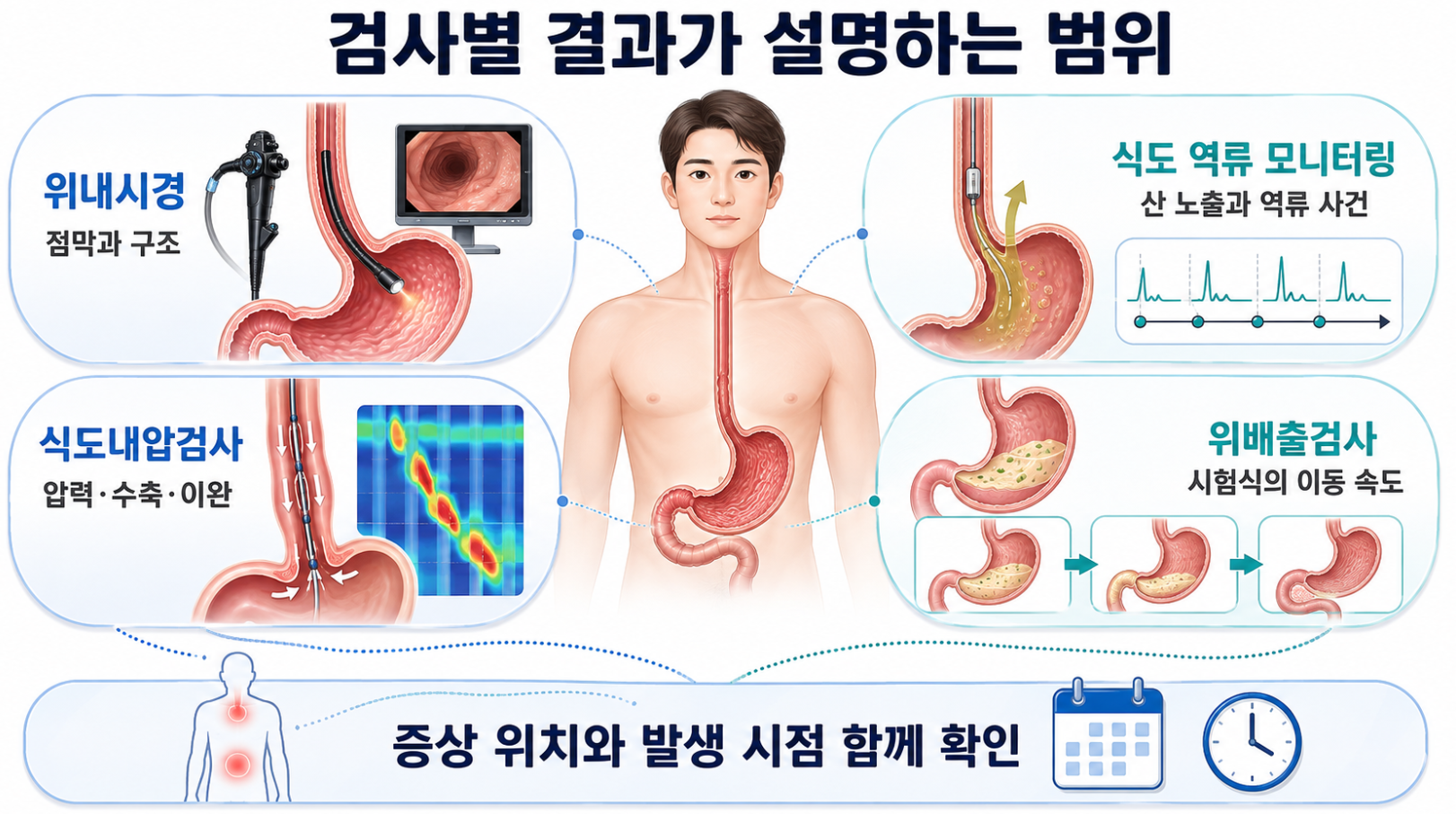 위내시경과 식도 기능검사별 결과가 설명하는 정보 범위