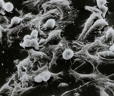 암보험 비교사이트 가격 추천상품